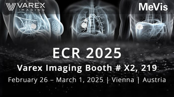 Meet MeVis at ECR 2025 at the Varex Imaging booth X2, 219 in Vienna, Austria.