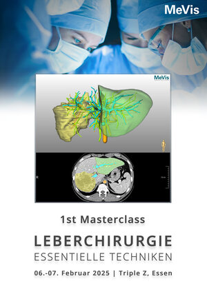 Masterclass Leberchirurgie in Essen - essentielle Techniken